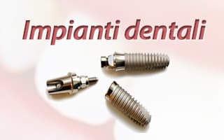 Impianti dentali