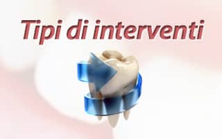 Tipi di interventi implantologia
