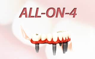 All On 4 - Tutto su 4