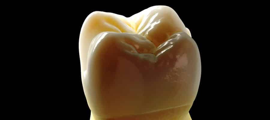 Implantoprotesi Laboratorio Odontotecnico